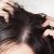 Effective hair mask to get rid of dandruff